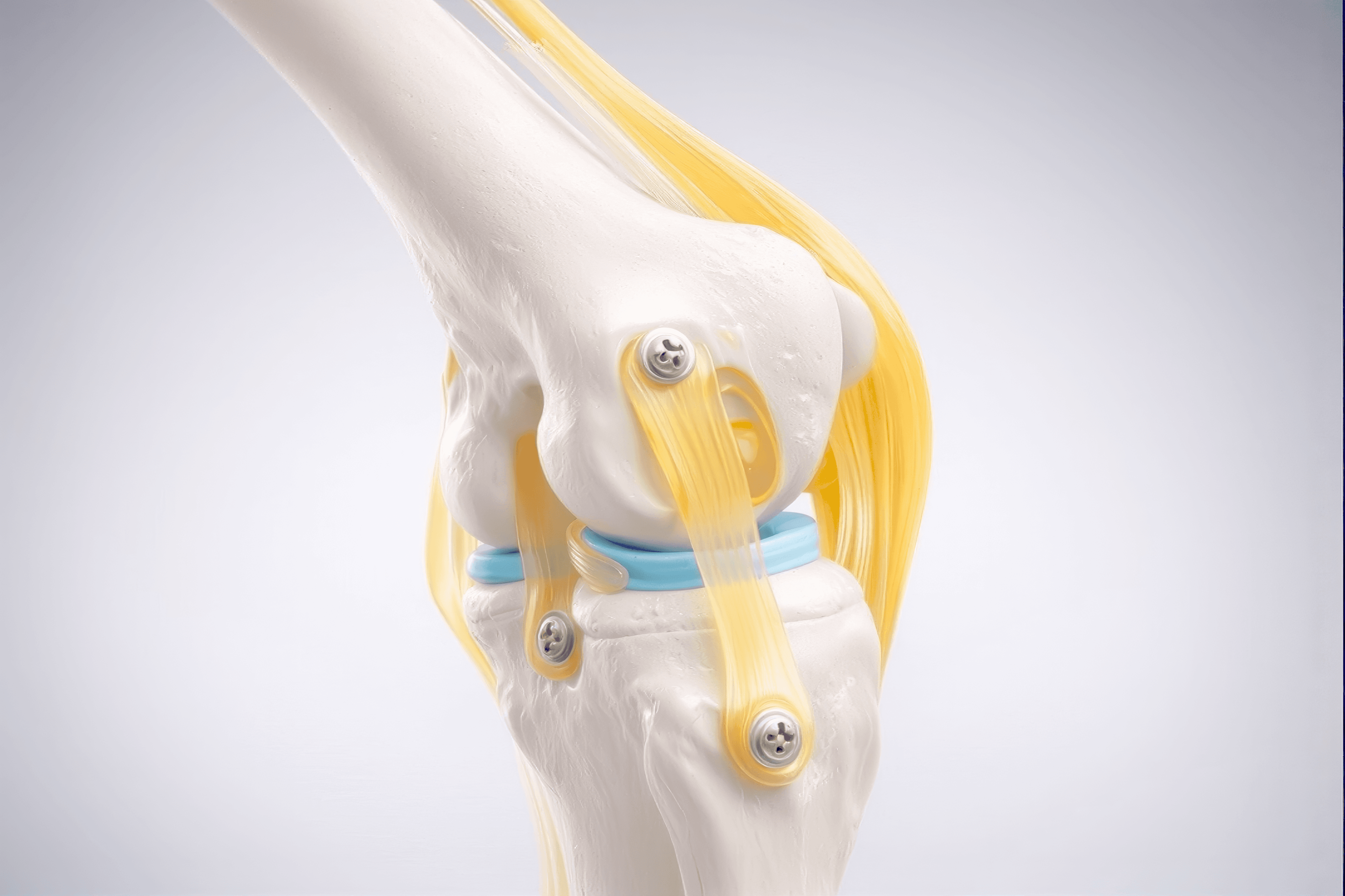 Kniegelenk Orthopädie